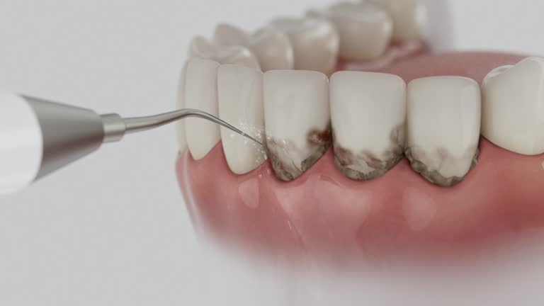 Trusted Wisdom Tooth Removal service in Edwards AFB, CA - Dentist Open Now